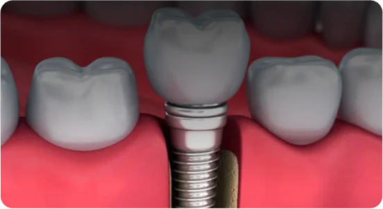 Vida nova para seus dentes!