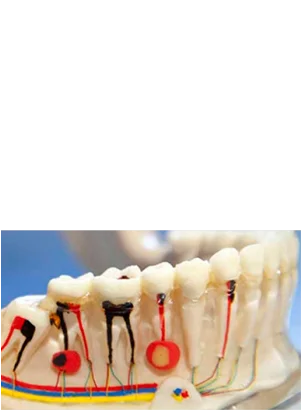 Tratamento de Canal Endodontia