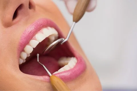 Tratamento de Canal | Endodontia